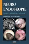Neuroendoskopie - technika, diagnostika, intervence